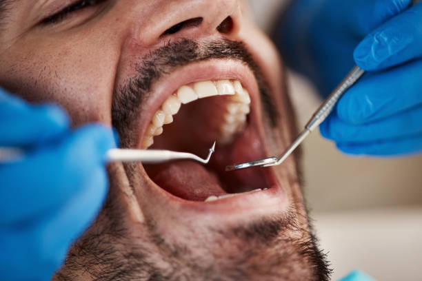 Best Emergency Dental Services for Seniors in Washington, NC