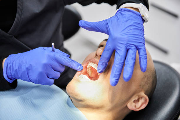 Best Emergency Root Canal Treatment in Washington, NC