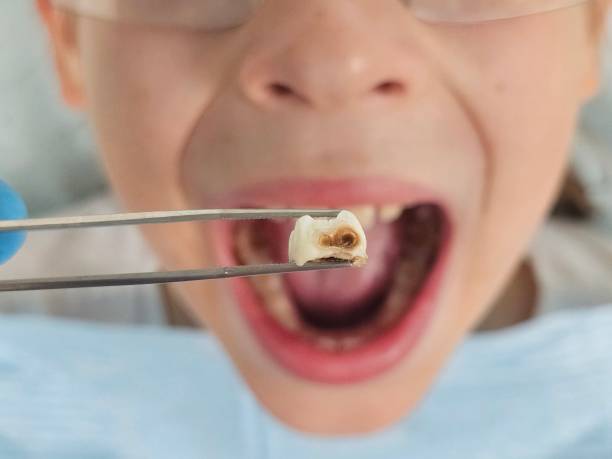 Best Mobile Emergency Dentist in Washington, NC
